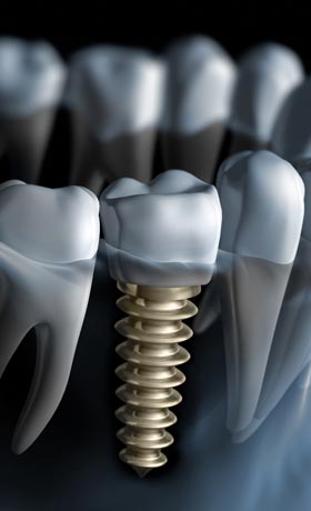 RestorativeDentistry